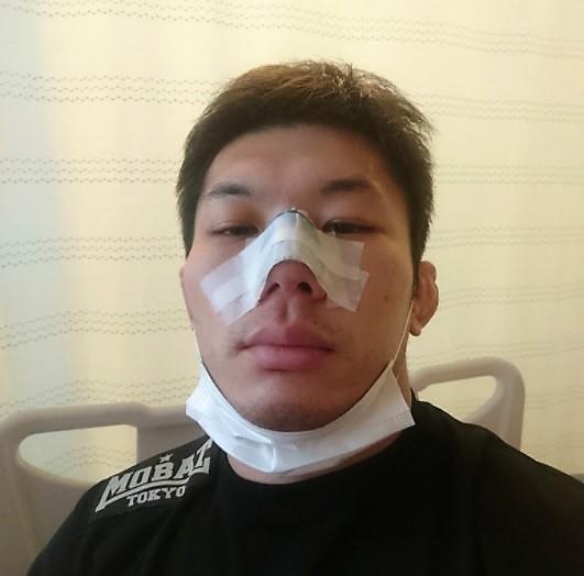 【RIZIN】斎藤裕が折れた鼻を手術、全治2カ月「相手のフックは強烈でした」